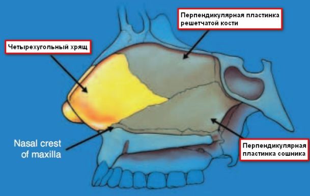 Искривление носовой перегородки картинки