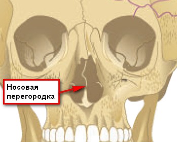 Искривление носовой перегородки фото
